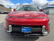 2025 Hyundai Kona SEL Convenience SUV